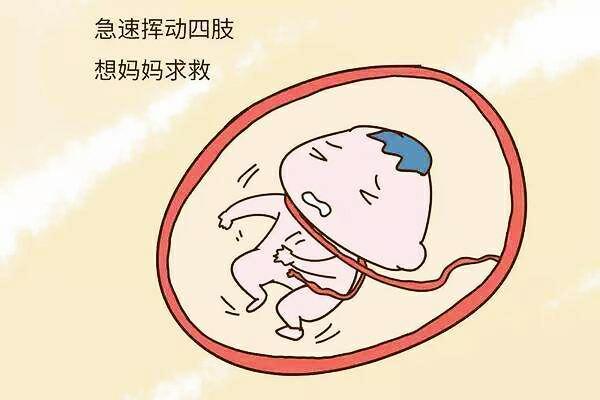 胎儿胎动好每天打嗝会缺氧吗